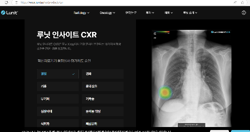 루닛, Lunit Insight, AI 영상 판독, 폐암 진단 AI