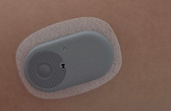 연속혈당 측정기