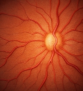 녹내장 초기증상