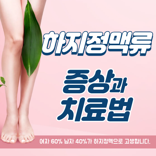 하지정맥류