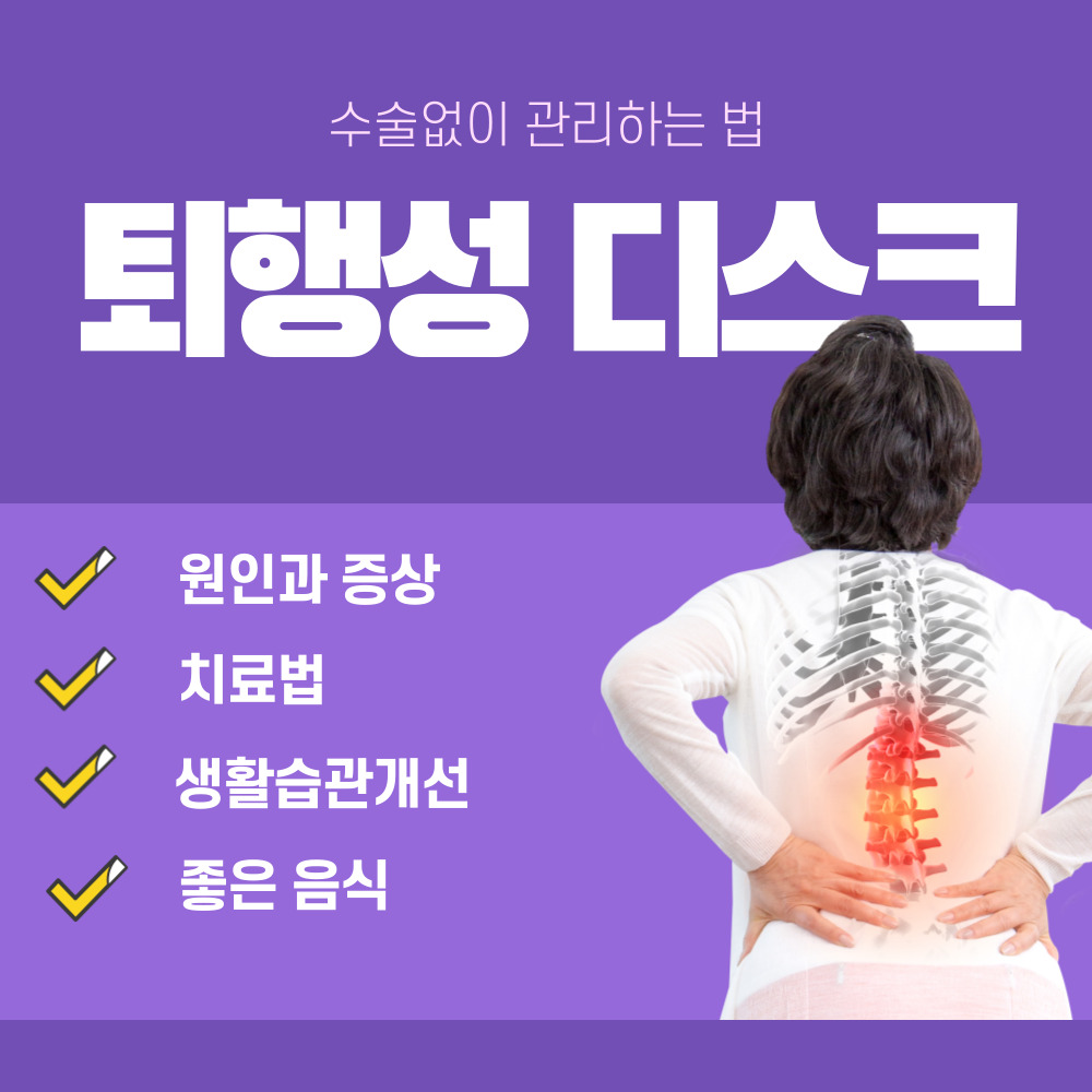 퇴행성 디스크, 수술 없이 관리하는 법