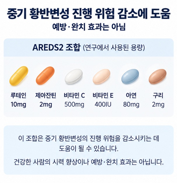 AREDS2 조합과 루테인 제아잔틴을 통해 황반변성 진행 위험 감소를 설명하는 이미지