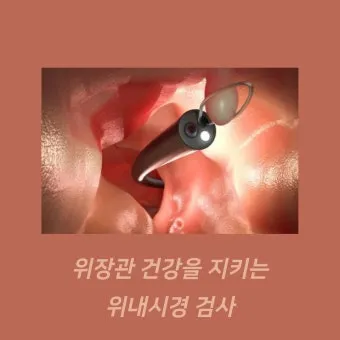 위내시경 금식시간 전날 음식 꼭 알아야 할 주의사항_25