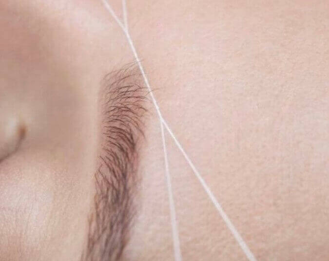 실로 쥐젖을 제거하는 모습