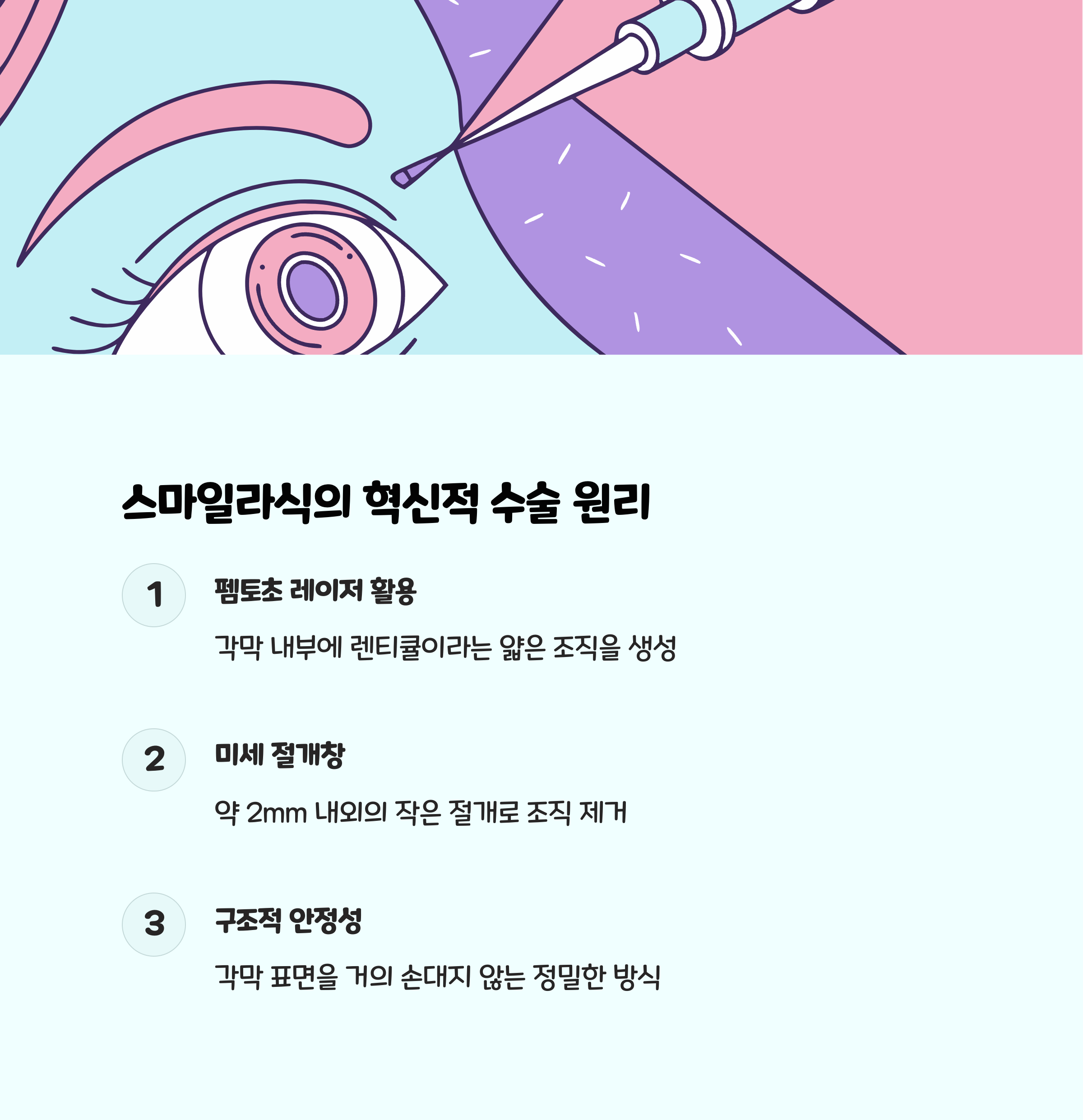 펨토초 레이저 기반의 혁신, 스마일라식의 수술 원리