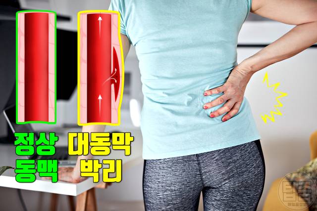 배에서 심장박동 복부대동맥류 증상 복부대동맥류 자가진단 등통증 옆구리통증