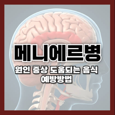 메니에르병
메니에르병 증상
메니에르병 원인
메니에르병 치료
메니에르병 예방
내이 질환
어지럼증 치료
이명
청력 저하
메니에르병 치료법
스트레스와 메니에르병
메니에르병 수술
메니에르병 식이 요법
내림프액
메니에르병의 예방 방법