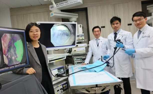이제 종양도 AI가 찾아낸다: 대장내시경 AI aids colonoscopy by acting as 'extra pair of eyes', spotting tumors