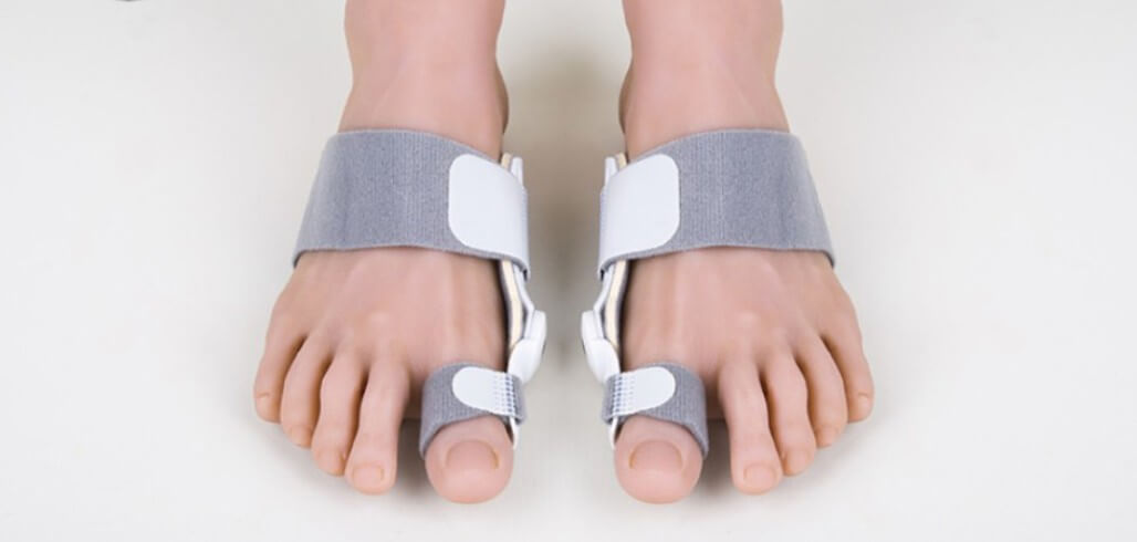 무지외반증 교정기 야간교정기