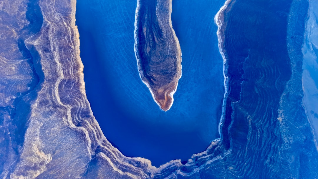 Prostate