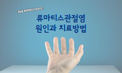 류마티스관절염_원인_증상_치료방법