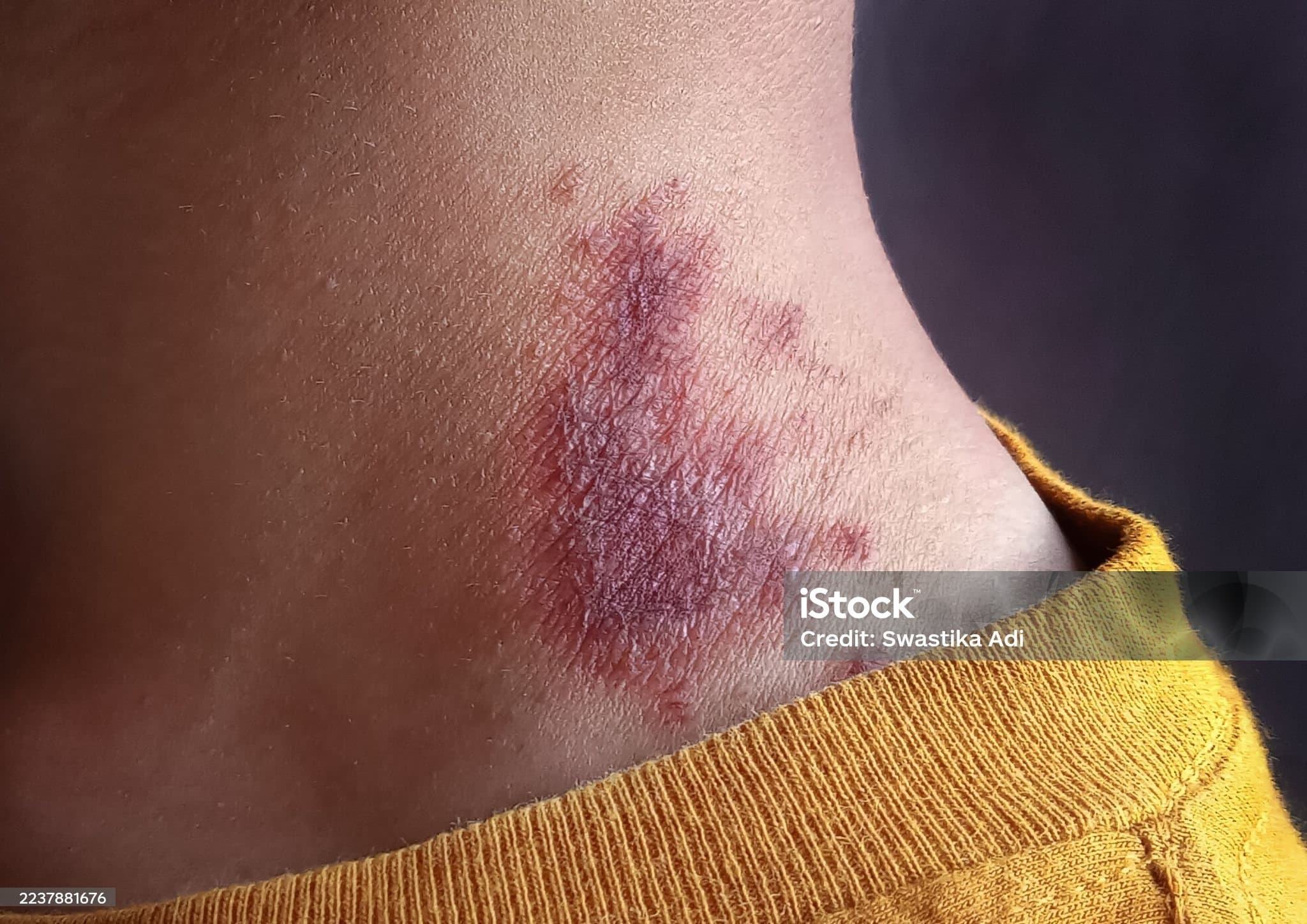 목에 멍울이 잡힐때&amp;#44; 그냥 두면 위험할까요?