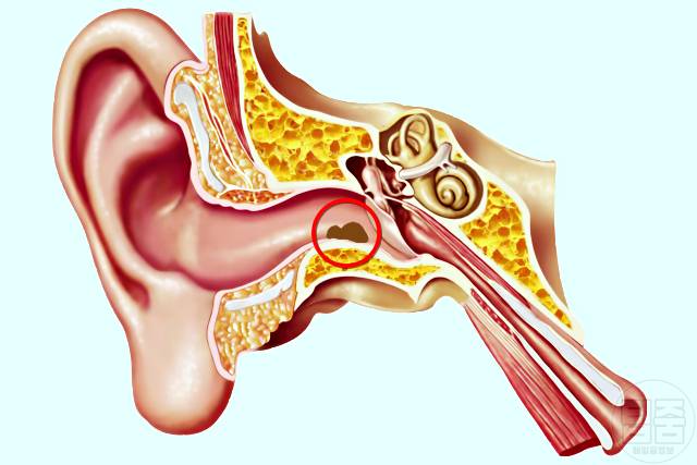피부암 호발 부위 피부암자가진단 귀 안쪽