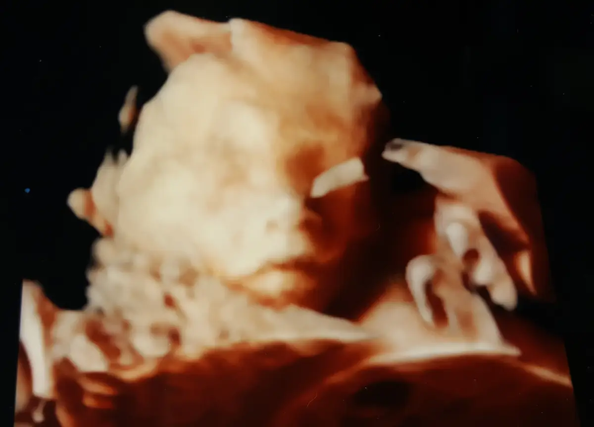 중기-정밀-초음파-사진