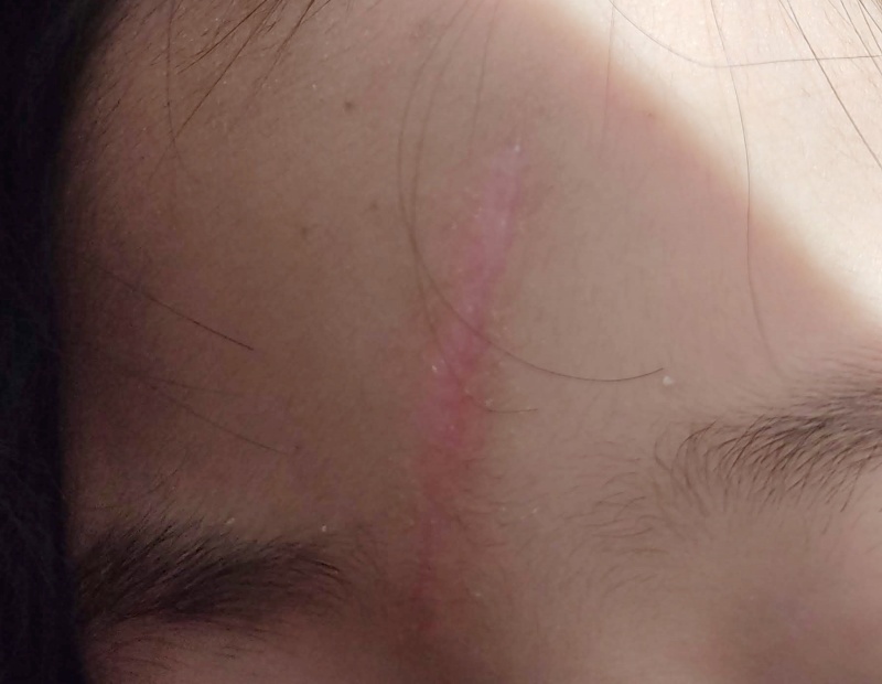 붉은끼가 많은 쿠앙이 현재 상태