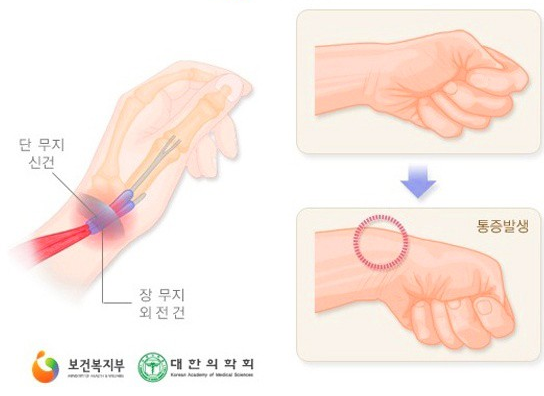 손목 통증 완화 운동
