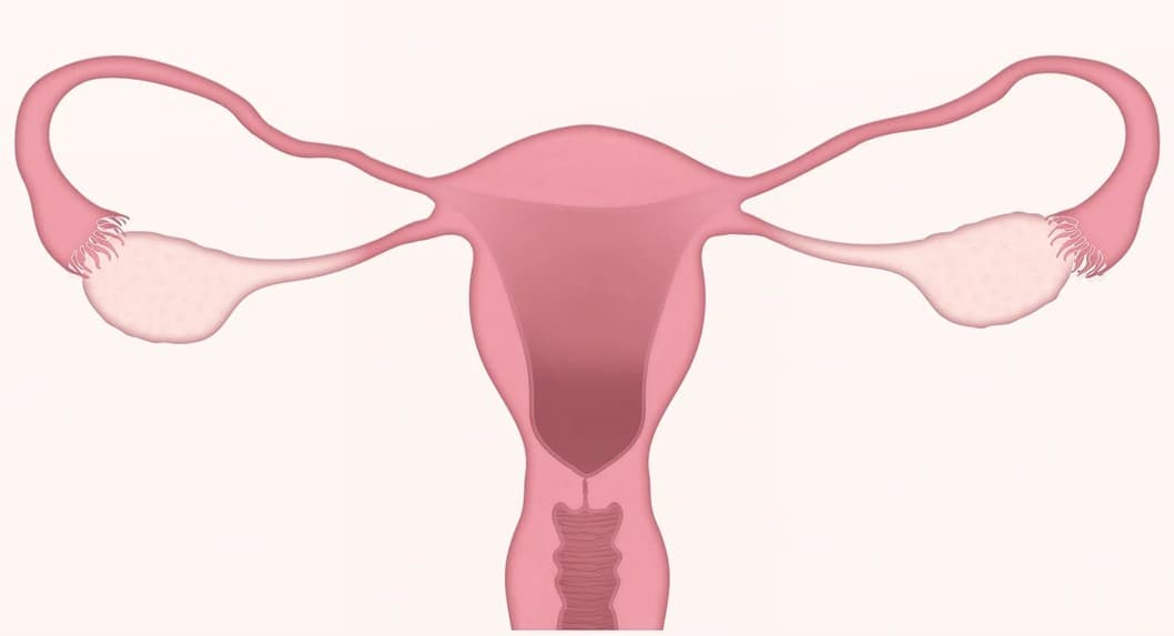 자궁근종 & 호르몬 균형, 인체에 미치는 영향 그리고 생활실천
