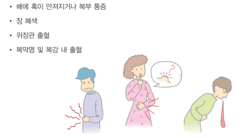 기스트 증상
