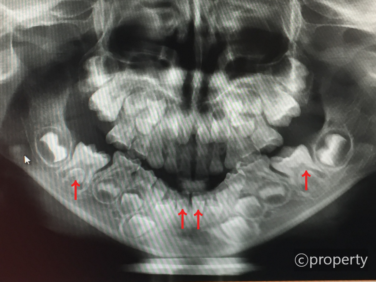 아이-치아-파노라마사진