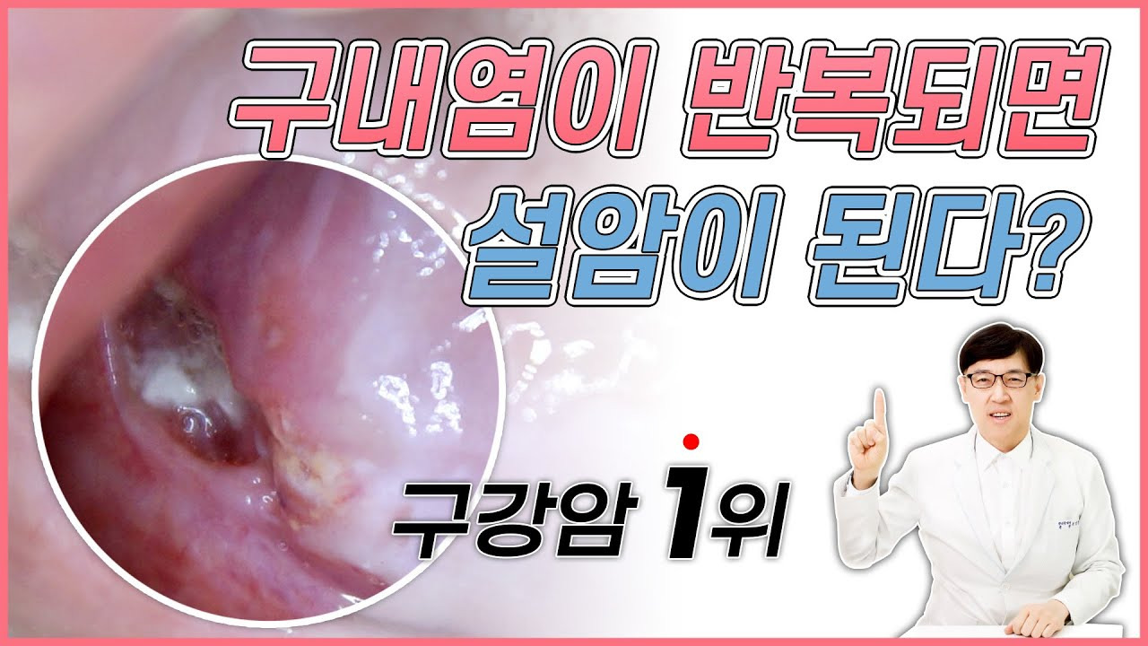 설암