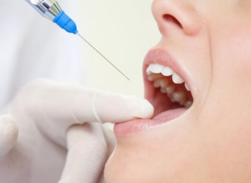 풍치의 초기 증상