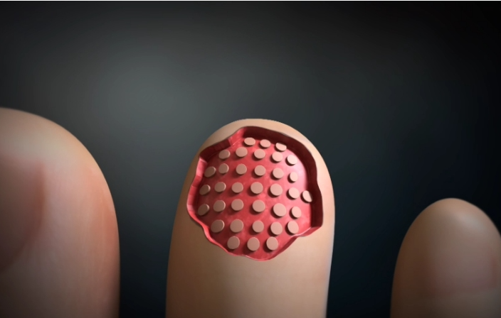 명의 피부암 점 구별법