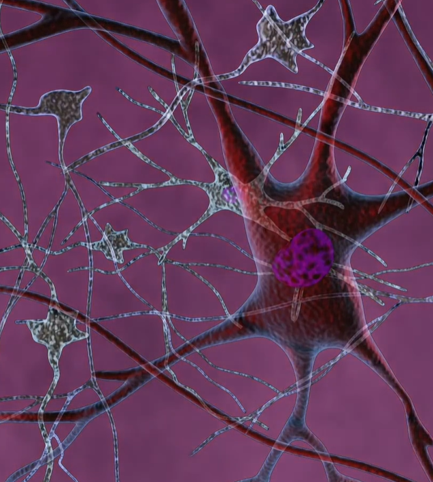 뇌경색 전조증상