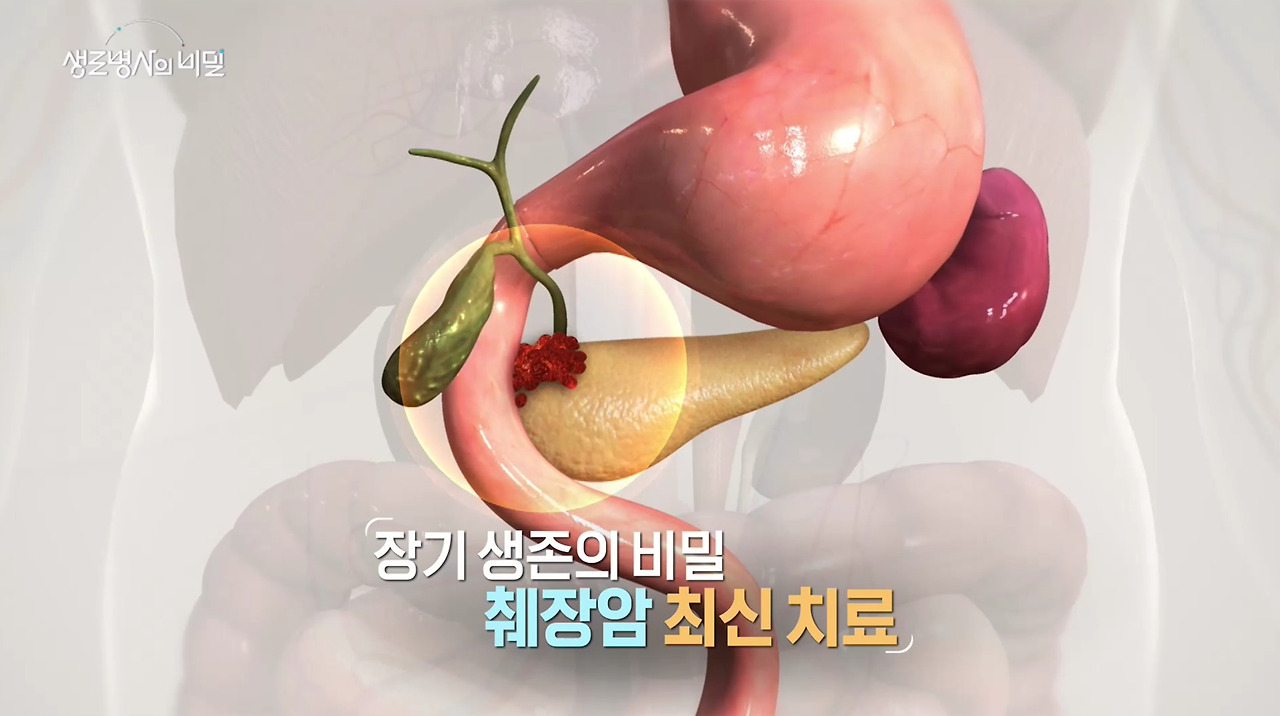 생로병사의 비밀