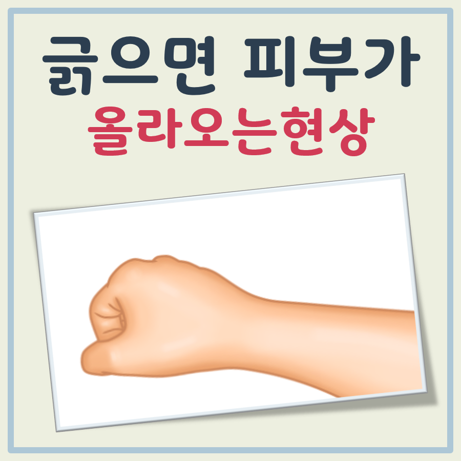 긁으면 피부가 올라오는현상