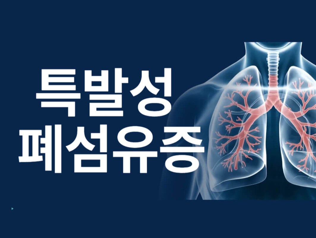 특발성 폐섬유증