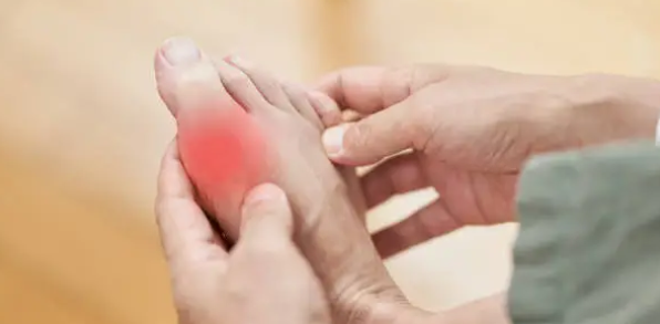 통풍과 관련된 사진