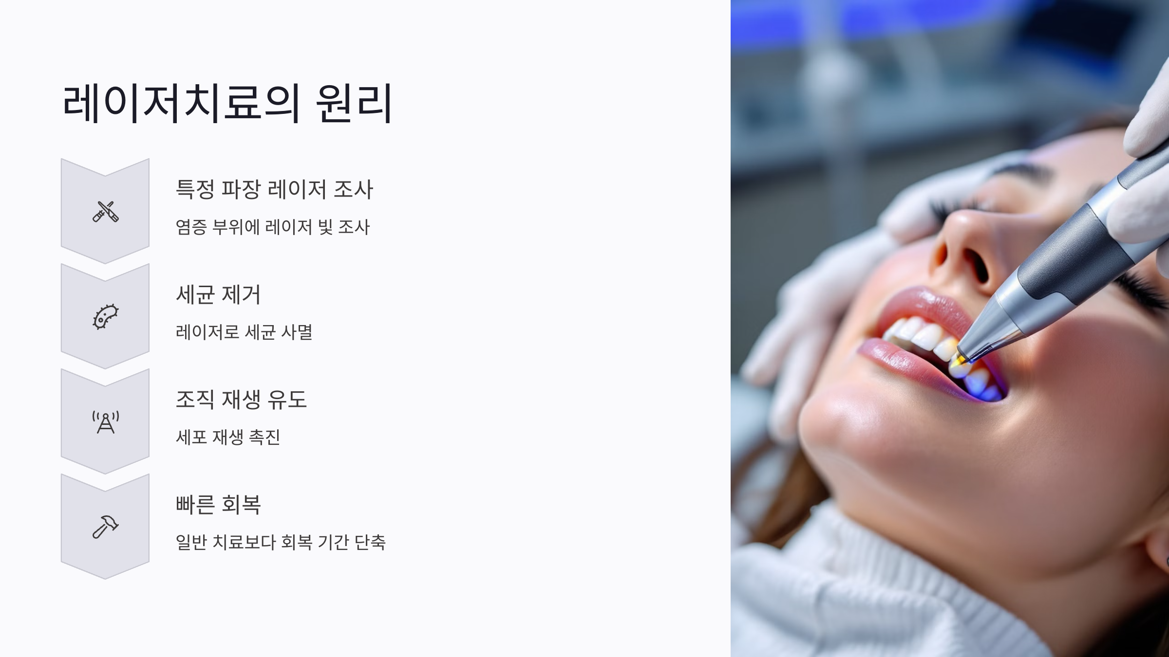 구내염 레이저치료란? 시술 원리와 치료 흐름