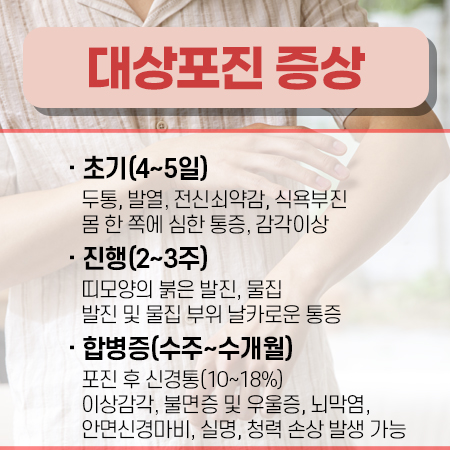 대상포진 초기증상
