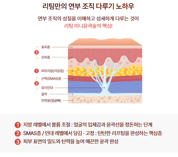 안면윤곽수술, 리팅미니윤곽술 신사역성형외과, 미니리프팅