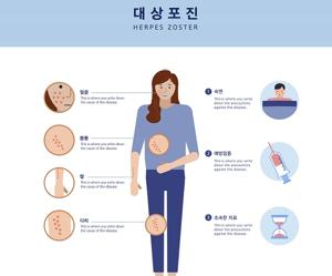 대상포진 통증완화방법,좋은음식,관리법(흉터,신경통),무료접종