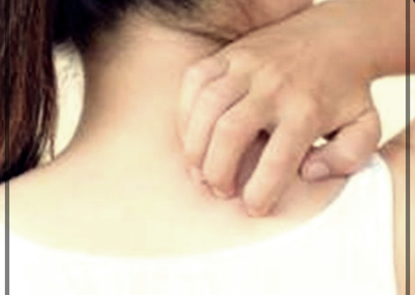 화폐성 피부염 치료방법에 대한 이해