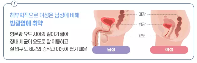 방광염 약국약 효과