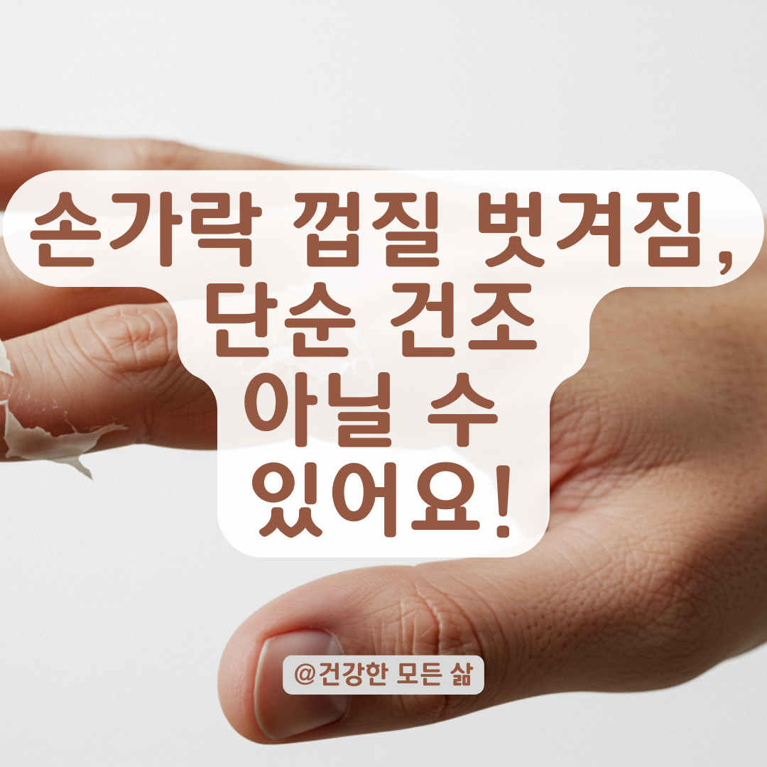 손가락 껍질이 계속 벗겨진다면? 의심해야 할 피부 질환 총정리.