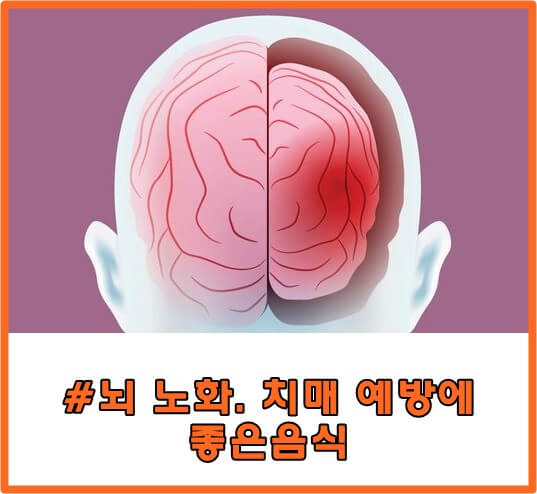 뇌 노화 방지 노력