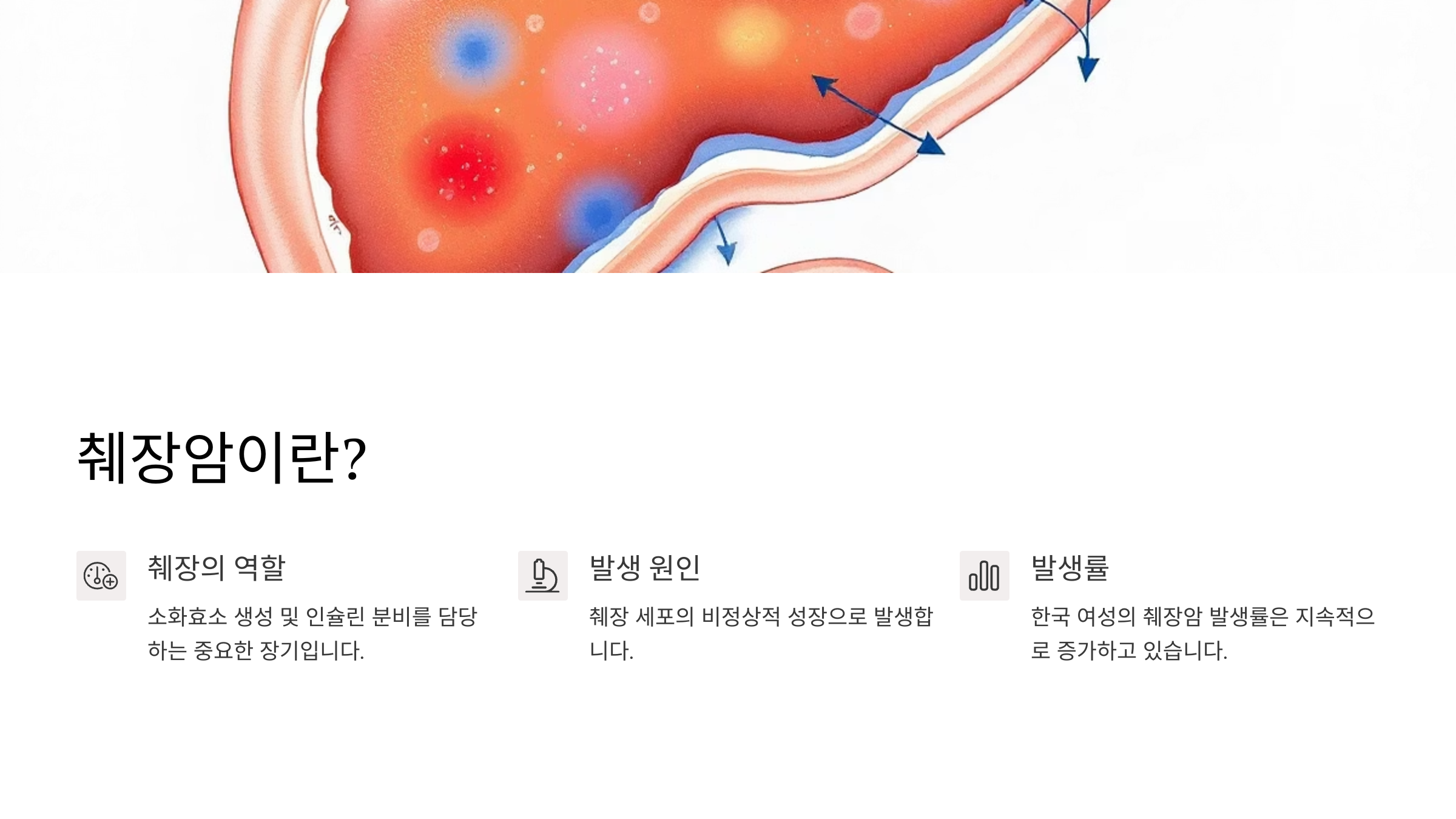 여자 췌장암 초기증상 2