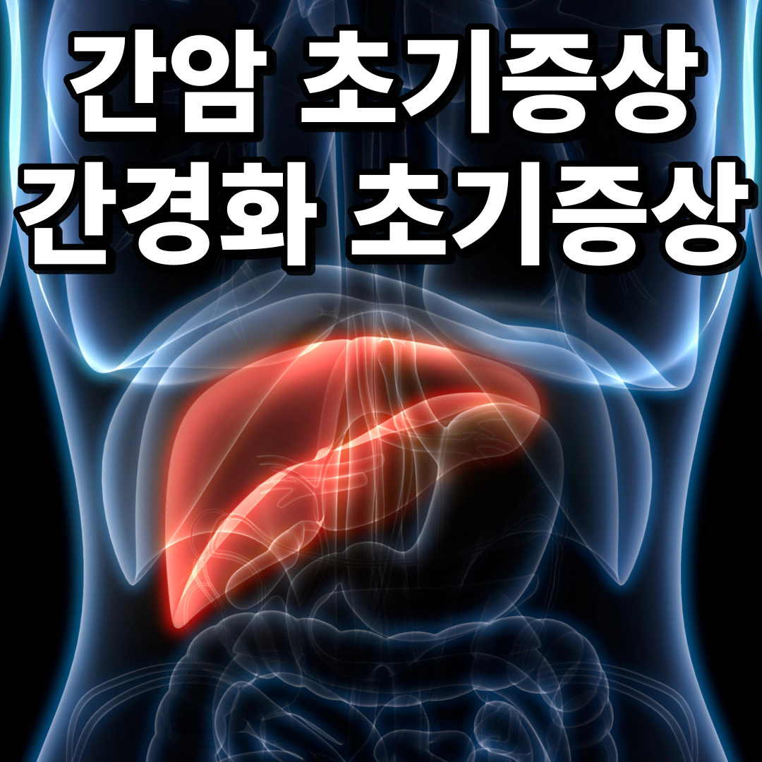 간암 초기증상 간경화 초기증상
