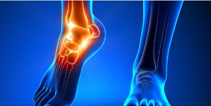 부주상골 관련 사진