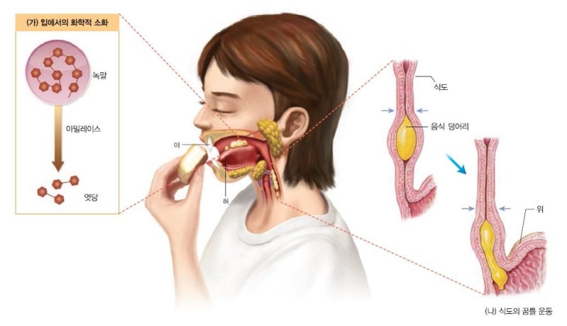 역류성 식도염 음식 관리&amp;#44; 무엇을 먹느냐보다 중요한 한 가지