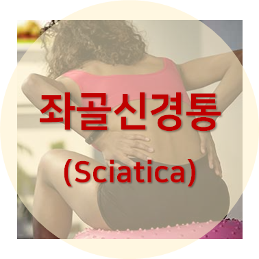 좌골신경통 포스팅 섬네일