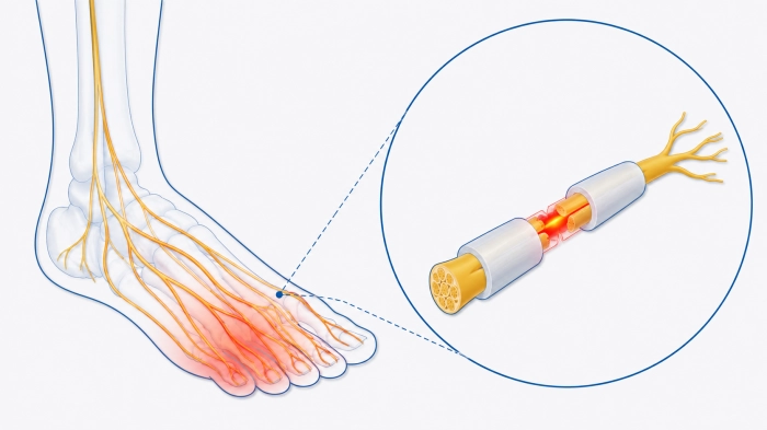발바닥이 화끈거리는 이유
