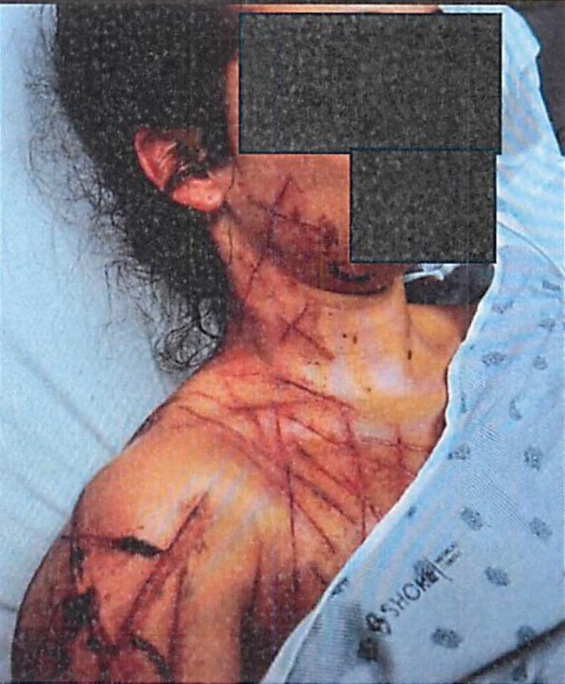 공화당 전직 보좌관, 스스로 폭행 조작극 꾸며 기소… 몸에 상처 내고 정치 문구까지 새겨