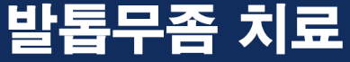발톱무좀 치료