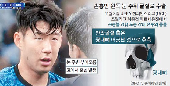 손흥민 수술