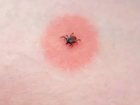 피부가려움증의 원인 24