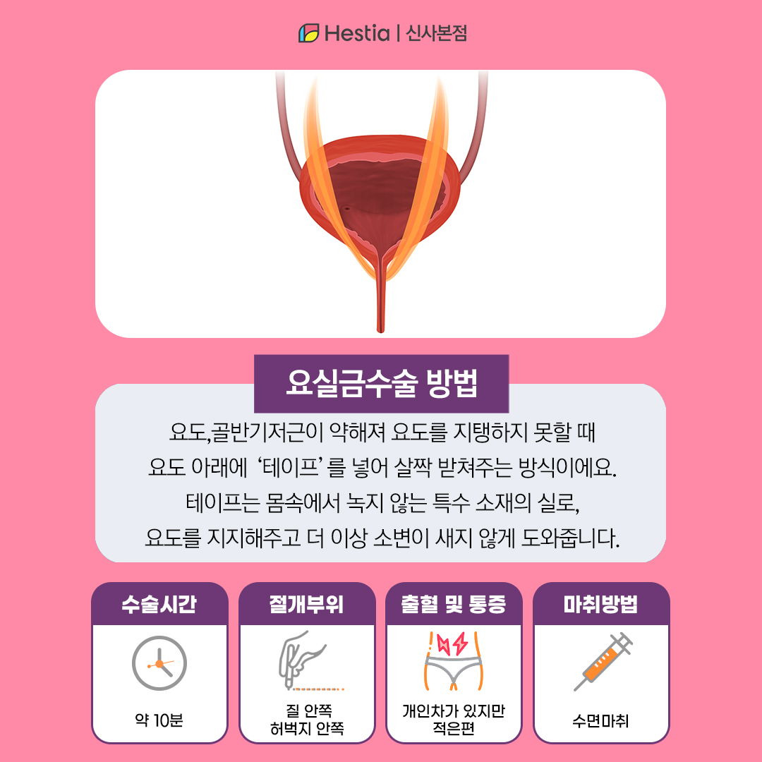 요실금 수술 어떻게 진행돼죠?